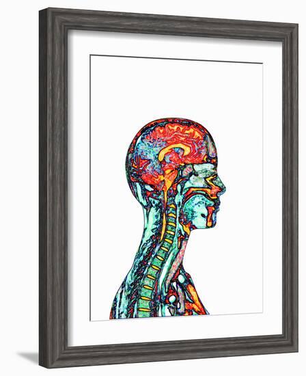 Brain And Spinal Cord, MRI-Mehau Kulyk-Framed Photographic Print