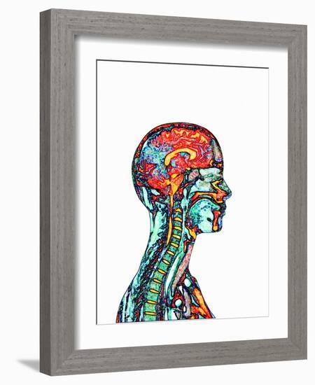 Brain And Spinal Cord, MRI-Mehau Kulyk-Framed Photographic Print