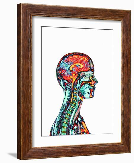 Brain And Spinal Cord, MRI-Mehau Kulyk-Framed Photographic Print