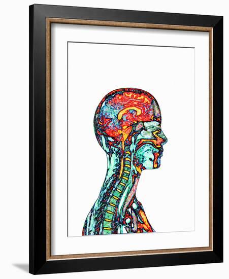 Brain And Spinal Cord, MRI-Mehau Kulyk-Framed Photographic Print