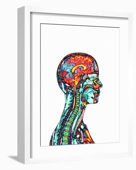 Brain And Spinal Cord, MRI-Mehau Kulyk-Framed Photographic Print