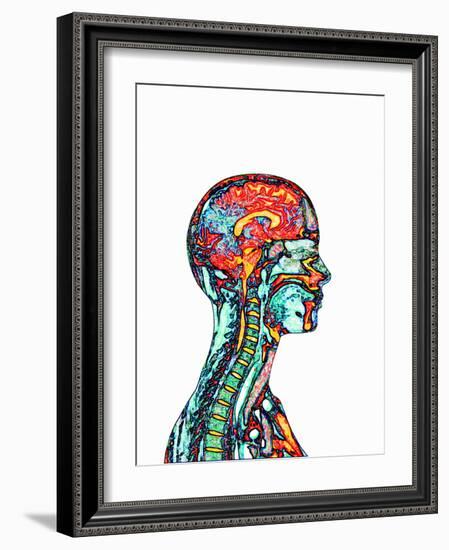 Brain And Spinal Cord, MRI-Mehau Kulyk-Framed Photographic Print