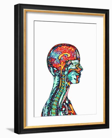 Brain And Spinal Cord, MRI-Mehau Kulyk-Framed Photographic Print