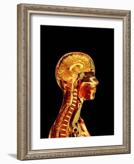 Brain And Spinal Cord-Mehau Kulyk-Framed Photographic Print