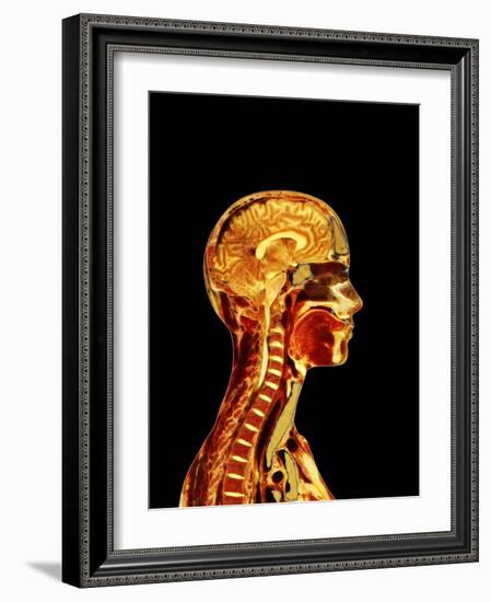 Brain And Spinal Cord-Mehau Kulyk-Framed Photographic Print