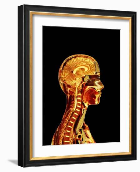 Brain And Spinal Cord-Mehau Kulyk-Framed Photographic Print