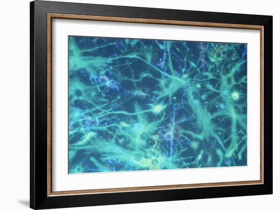 Brain Cells-Dr. Neal Scolding-Framed Photographic Print