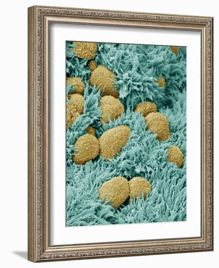 Brain Lining-Steve Gschmeissner-Framed Photographic Print