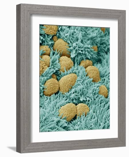 Brain Lining-Steve Gschmeissner-Framed Photographic Print