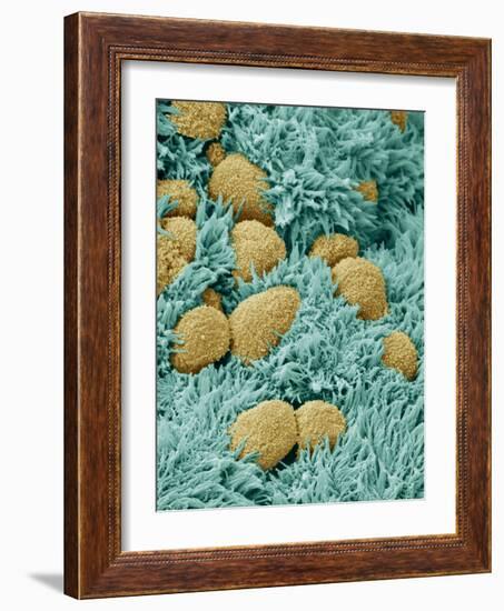 Brain Lining-Steve Gschmeissner-Framed Photographic Print