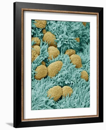 Brain Lining-Steve Gschmeissner-Framed Photographic Print