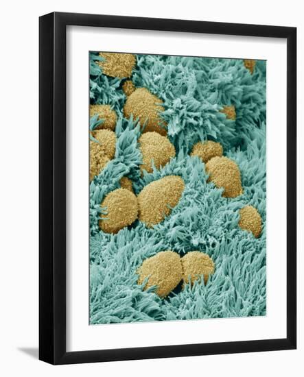 Brain Lining-Steve Gschmeissner-Framed Photographic Print