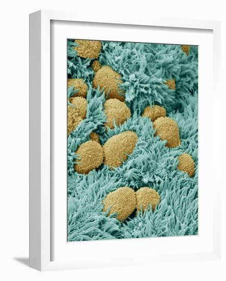 Brain Lining-Steve Gschmeissner-Framed Photographic Print