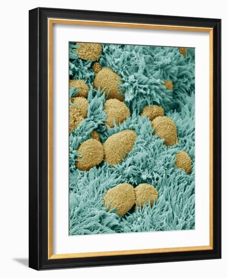 Brain Lining-Steve Gschmeissner-Framed Photographic Print