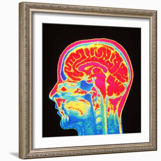 Brain, MRI Scan-Mehau Kulyk-Framed Premium Photographic Print