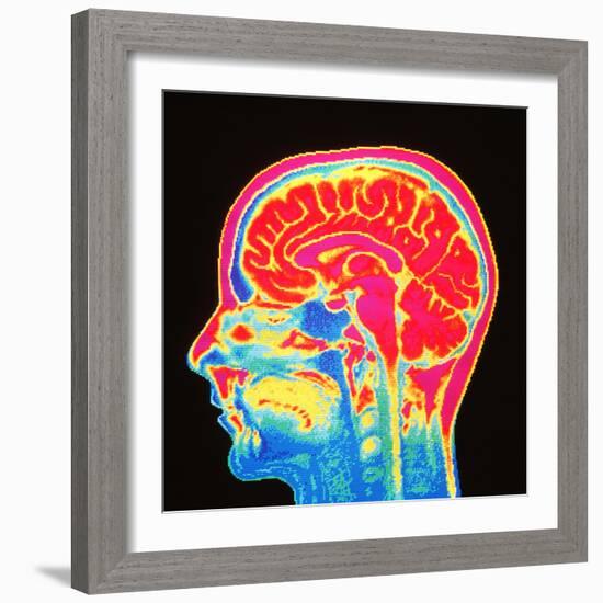 Brain, MRI Scan-Mehau Kulyk-Framed Premium Photographic Print