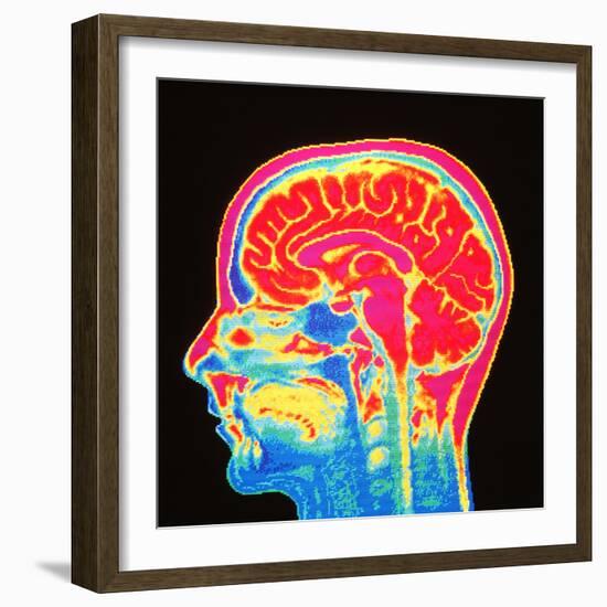 Brain, MRI Scan-Mehau Kulyk-Framed Premium Photographic Print