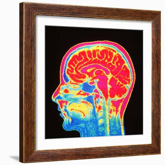 Brain, MRI Scan-Mehau Kulyk-Framed Premium Photographic Print