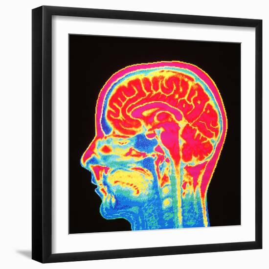 Brain, MRI Scan-Mehau Kulyk-Framed Premium Photographic Print