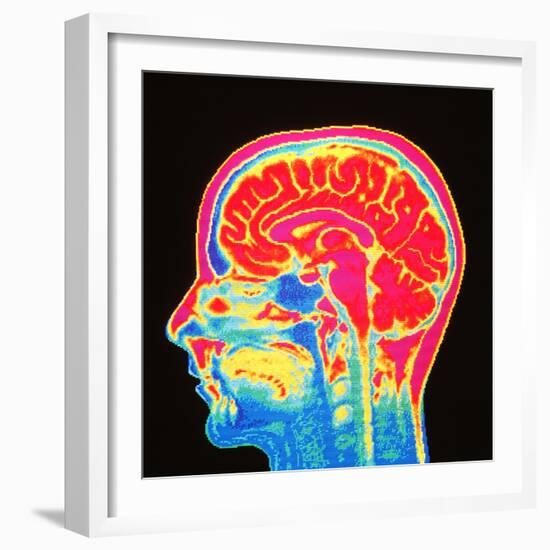 Brain, MRI Scan-Mehau Kulyk-Framed Premium Photographic Print