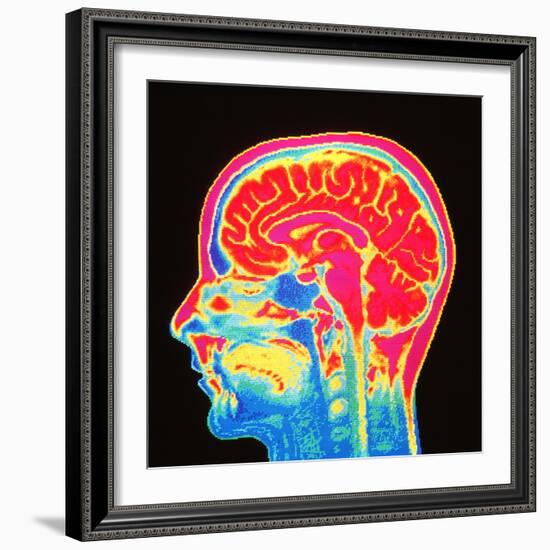 Brain, MRI Scan-Mehau Kulyk-Framed Premium Photographic Print