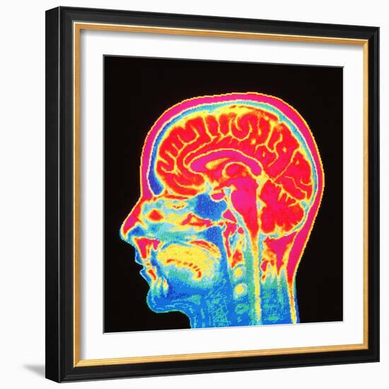 Brain, MRI Scan-Mehau Kulyk-Framed Premium Photographic Print