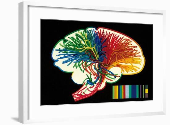 Brain. Nerve Fibers. Memory and Thinking. Drawing. Color-null-Framed Giclee Print