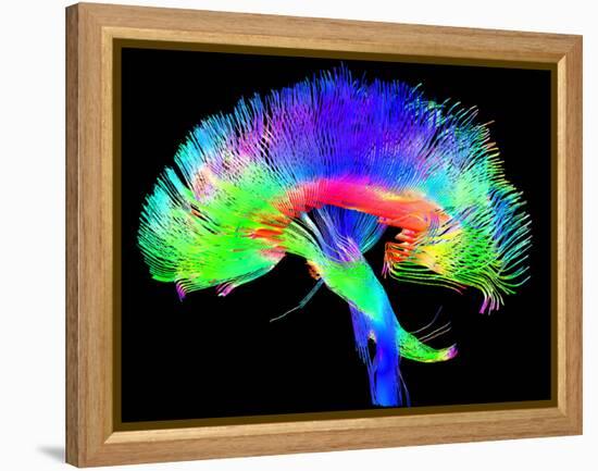 Brain Pathways-Tom-Framed Premier Image Canvas