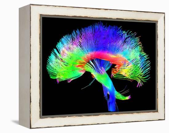 Brain Pathways-Tom-Framed Premier Image Canvas