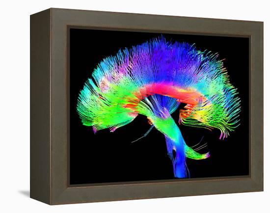 Brain Pathways-Tom-Framed Premier Image Canvas