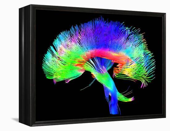 Brain Pathways-Tom-Framed Premier Image Canvas