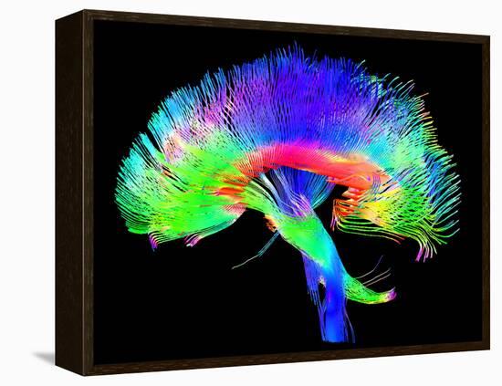 Brain Pathways-Tom-Framed Premier Image Canvas