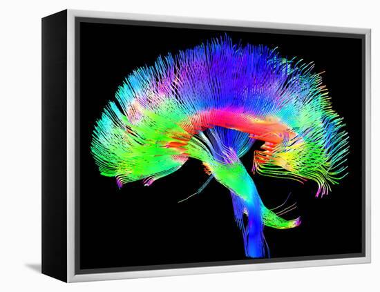 Brain Pathways-Tom-Framed Premier Image Canvas