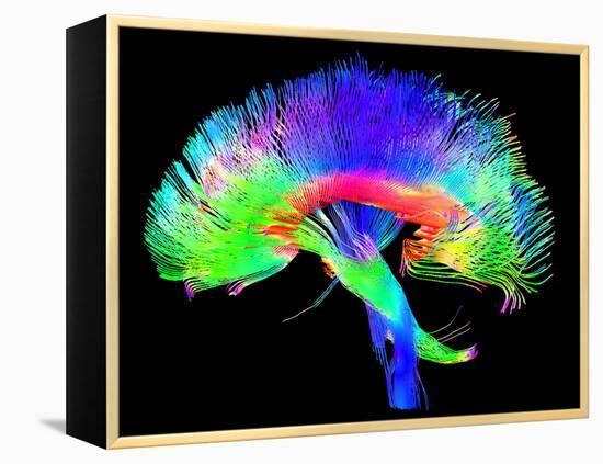 Brain Pathways-Tom-Framed Premier Image Canvas