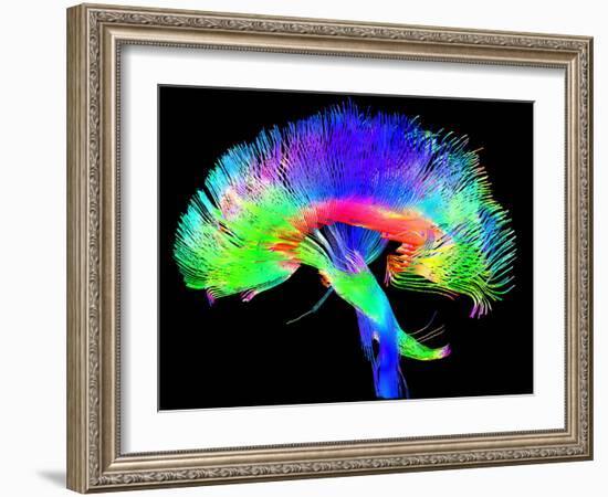 Brain Pathways-Tom-Framed Photographic Print