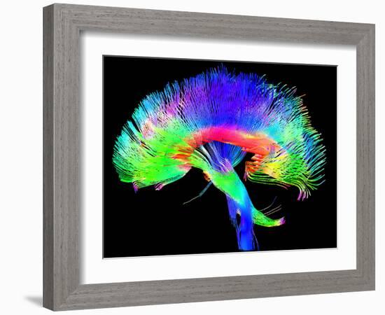 Brain Pathways-Tom-Framed Photographic Print