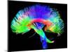 Brain Pathways-Tom-Mounted Photographic Print