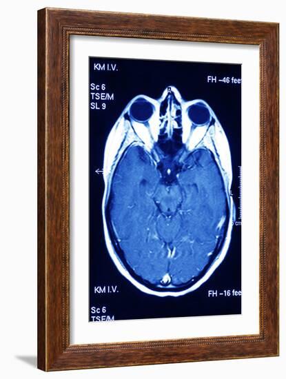 Brain Scan, MRI Scan-PASIEKA-Framed Photographic Print