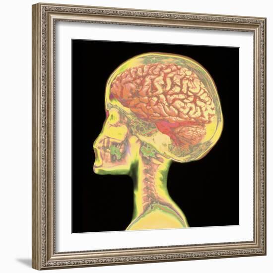 Brain Superimposed on Colour X-ray of Human Skull-Mehau Kulyk-Framed Premium Photographic Print