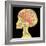 Brain Superimposed on Colour X-ray of Human Skull-Mehau Kulyk-Framed Premium Photographic Print