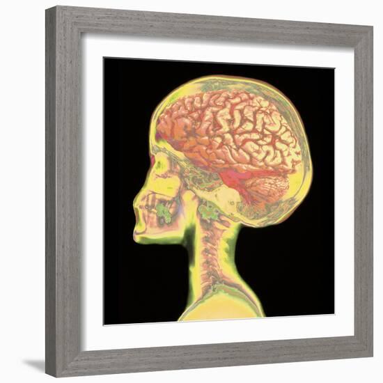 Brain Superimposed on Colour X-ray of Human Skull-Mehau Kulyk-Framed Premium Photographic Print