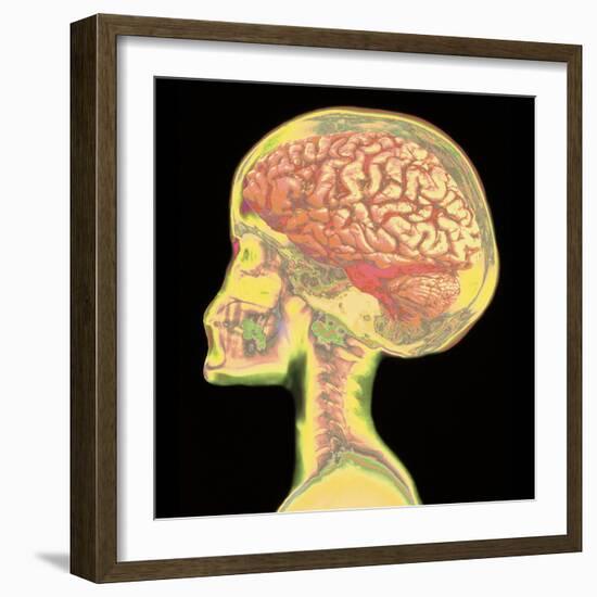 Brain Superimposed on Colour X-ray of Human Skull-Mehau Kulyk-Framed Premium Photographic Print