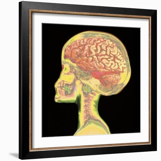 Brain Superimposed on Colour X-ray of Human Skull-Mehau Kulyk-Framed Premium Photographic Print