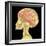 Brain Superimposed on Colour X-ray of Human Skull-Mehau Kulyk-Framed Premium Photographic Print