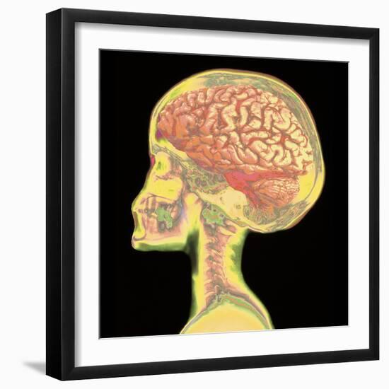 Brain Superimposed on Colour X-ray of Human Skull-Mehau Kulyk-Framed Premium Photographic Print