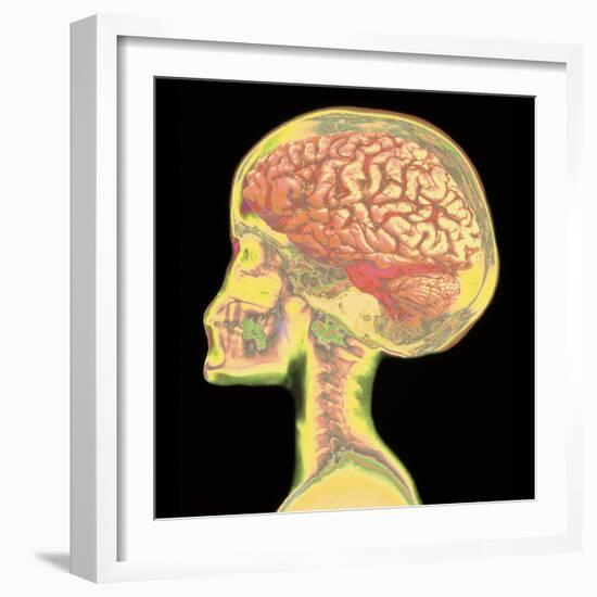 Brain Superimposed on Colour X-ray of Human Skull-Mehau Kulyk-Framed Premium Photographic Print