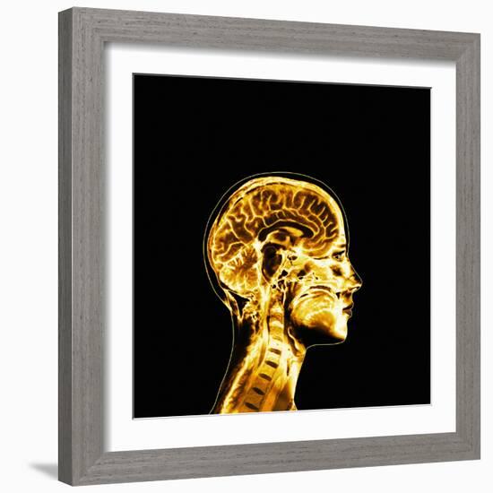 Brain-Mehau Kulyk-Framed Premium Photographic Print