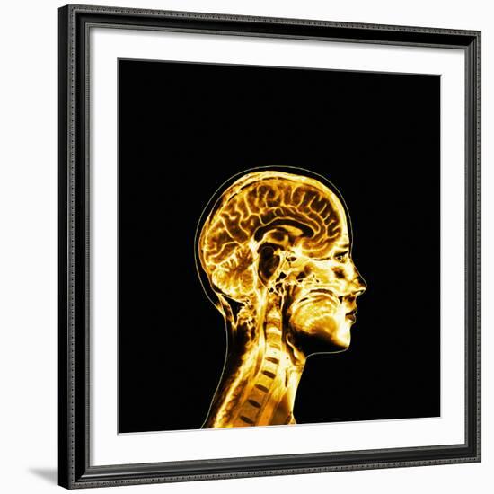 Brain-Mehau Kulyk-Framed Photographic Print