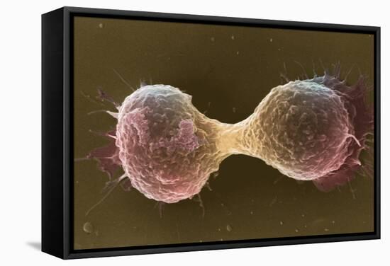 Breast Cancer Cells, SEM-Steve Gschmeissner-Framed Premier Image Canvas