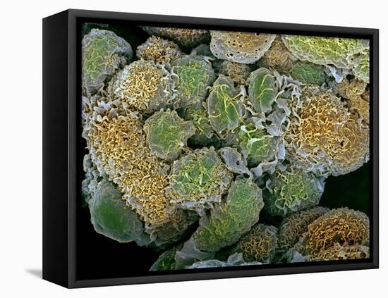 Breast Cancer Cells, SEM-Steve Gschmeissner-Framed Premier Image Canvas